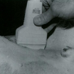 Ultrasonido Evaluación Renal